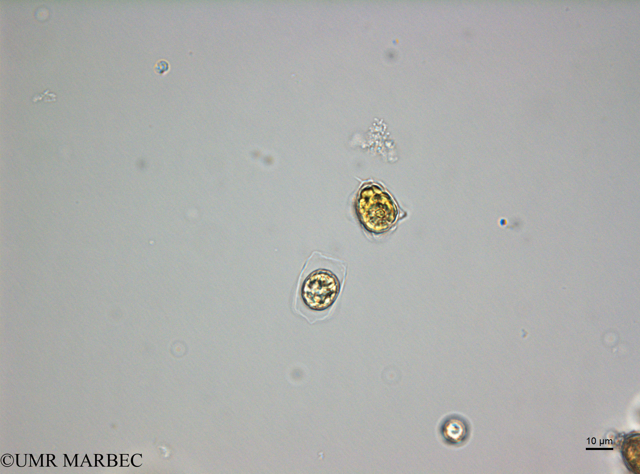 phyto/Scattered_Islands/juan_de_nova/COMMA2 November 2013/Cerataulina sp1 (D5_2_diatomee_ancien_melosira180717_001_ovl-21)(copy).jpg